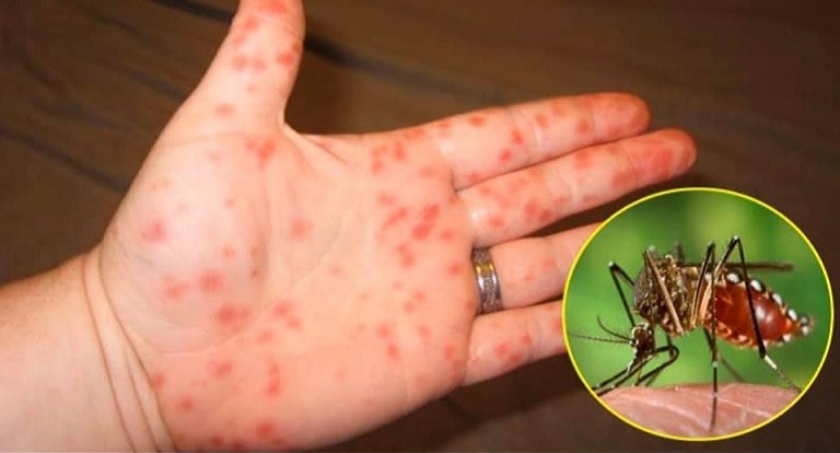 Những con số lên tiếng về dịch sốt xuất huyết!